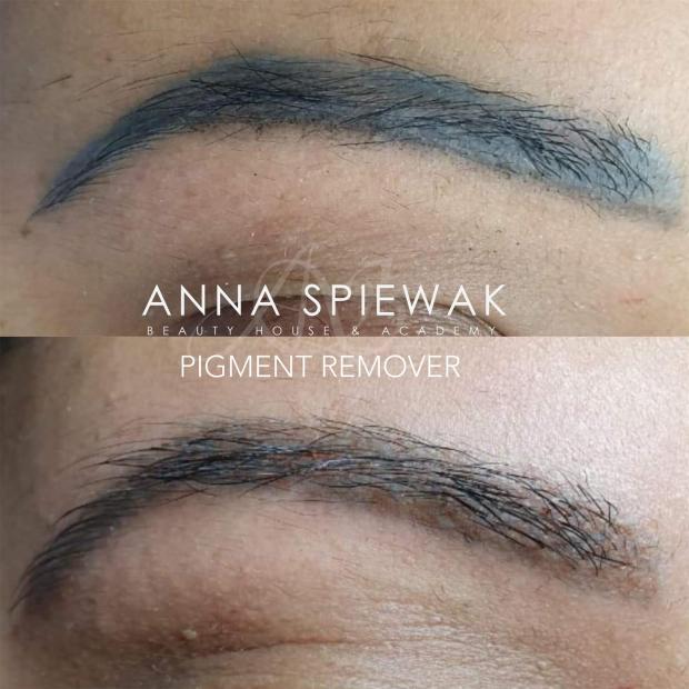 Szkolenie z removera online