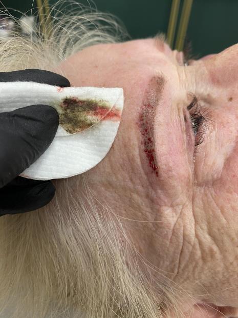 Szkolenie z removera online