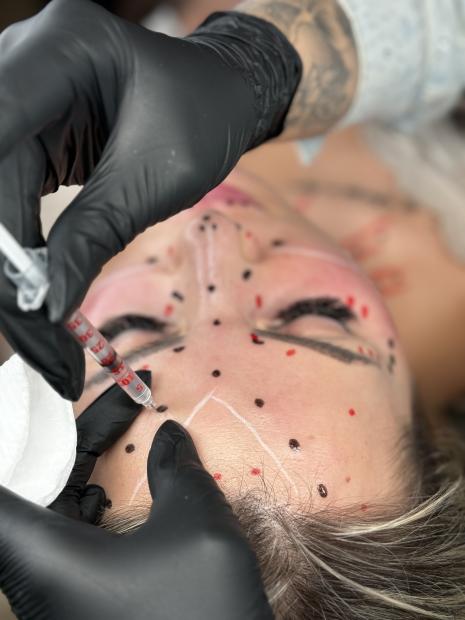 BTX EFFECT - poziom podstawowy