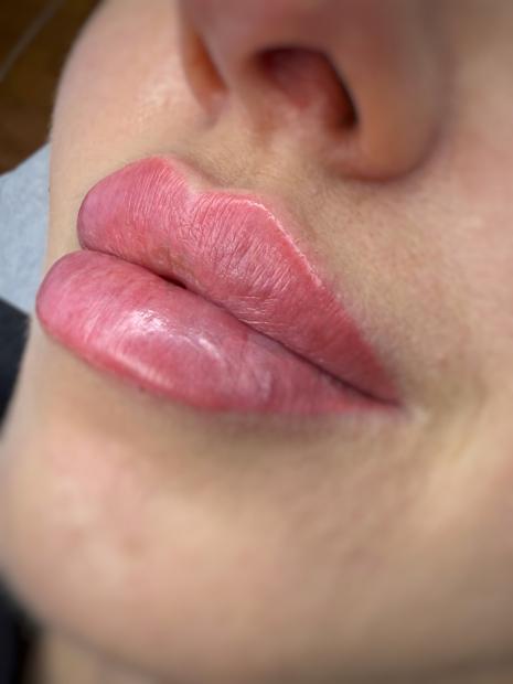 Szkolenie z Wypełniania i Modelowania ust